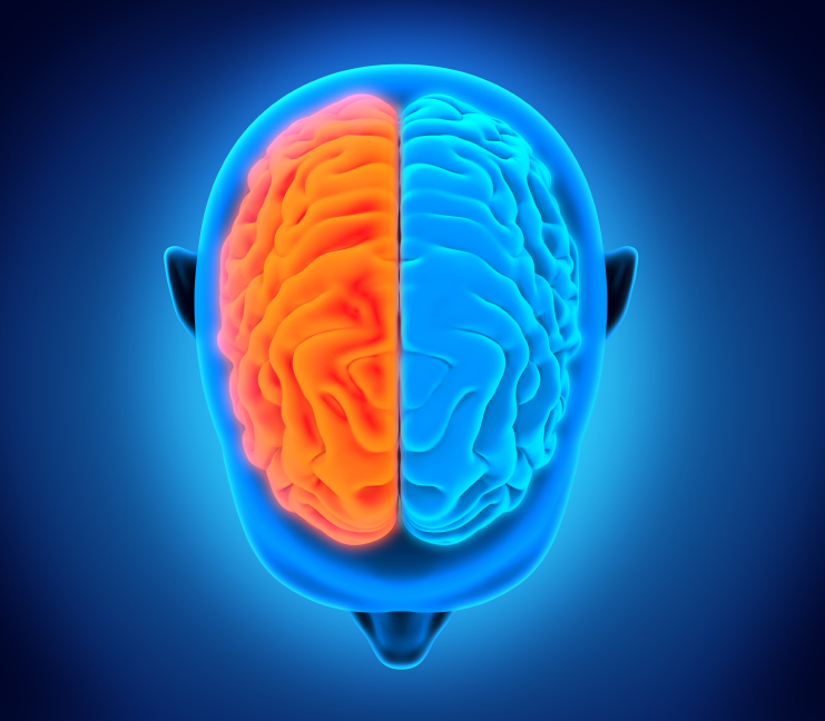 Stroke effects on the brain